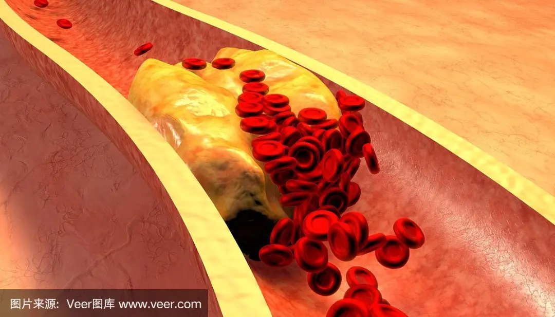 动脉.jpg